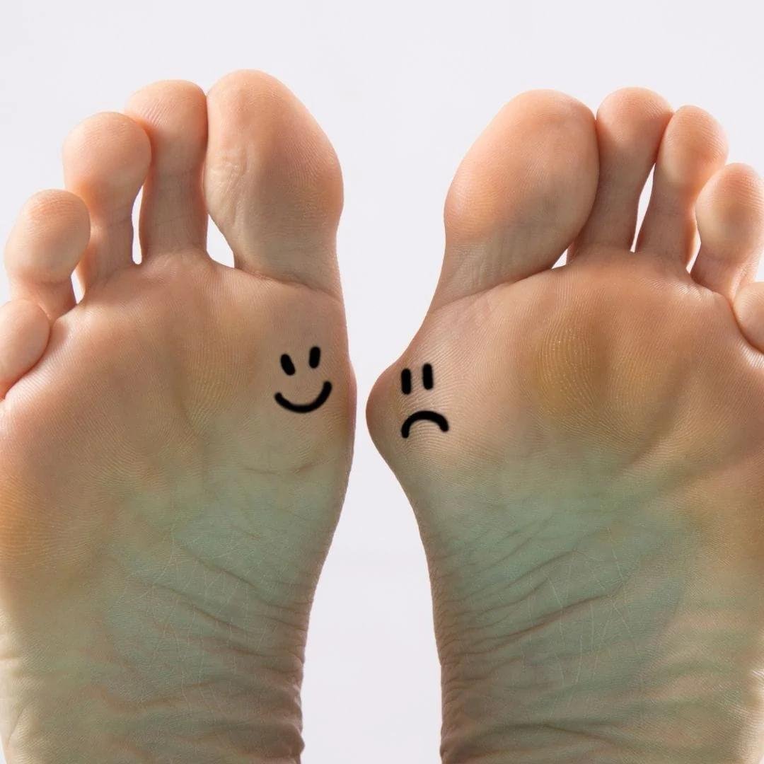 Informations sur les Hallux - A SUPPRIMER - Chaussuresraoul